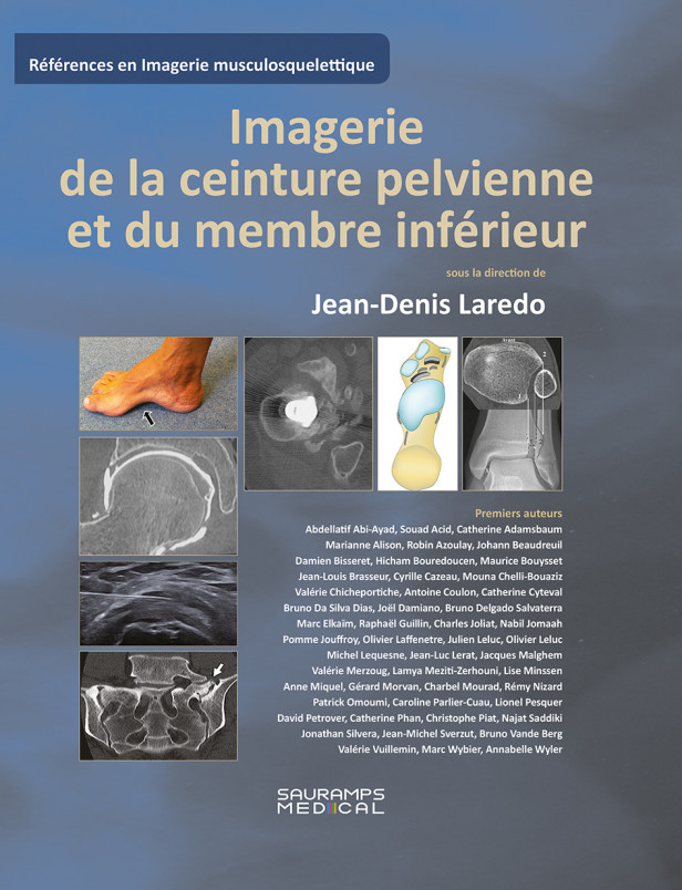 Imagerie de la ceinture pelvienne et du membre inférieur