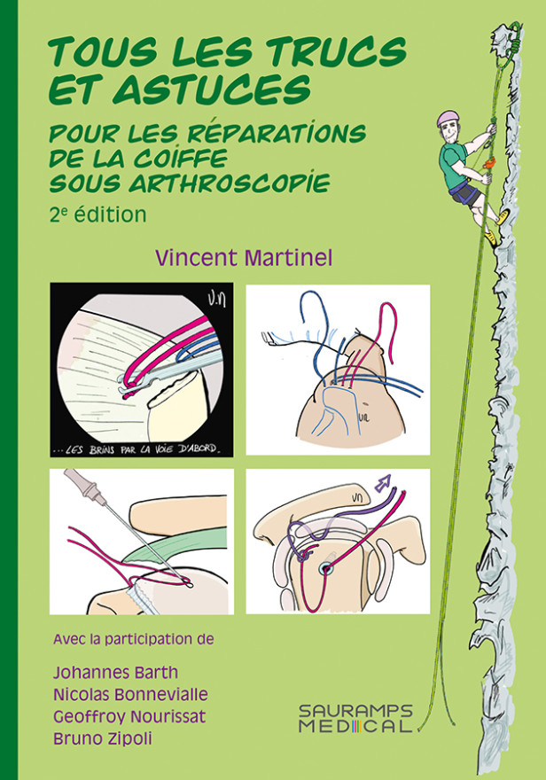 Tous les trucs et astuces pour les réparations de la coiffe sous arthroscopie