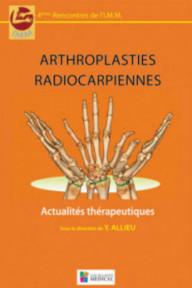 Arthroplasties...