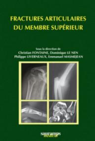 Fractures articulaires du...